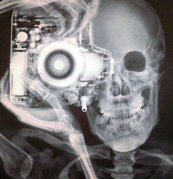 579x600, 58 Kb / рентген, фотоаппарат, череп